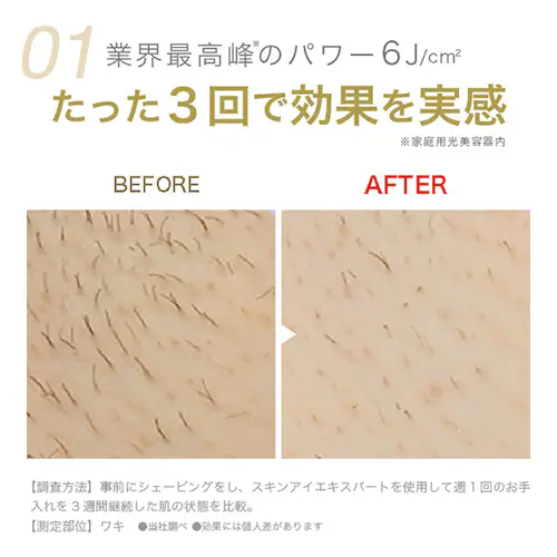 BRAUN 光美容器 シルクエキスパート PL-5137 【プラザセレクト】_5