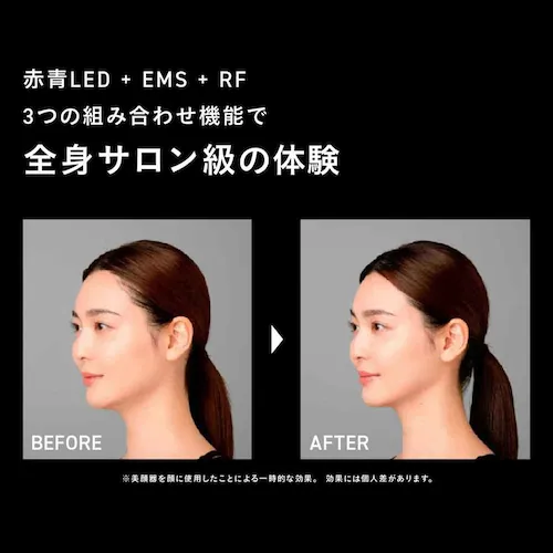 ブライト ELEKI BRUSH+(エレキブラシプラス) ブラック BRT-FSB180 【プラザセレクト】_3