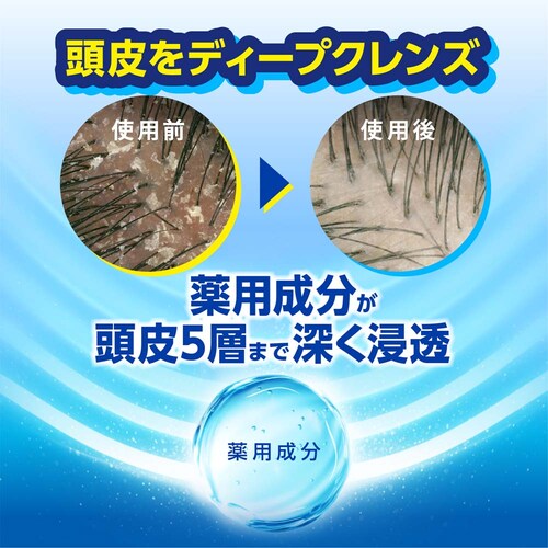 h&s シャンプー つめかえ超特大サイズ2.8倍 シトラスオイルコントロール_3