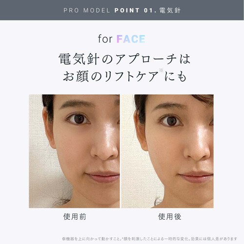電気針ヘッドスパ EMS HEAD SPA PRO MT-EHP22B-B_3