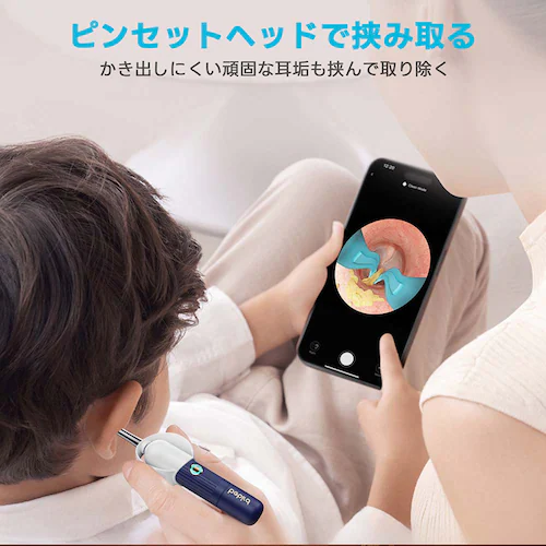 bebird スマート見える耳かき bebird Note6 Navy ネイビー IOT-BD-N6-NV_12