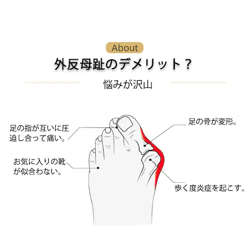 外反母趾サポーター シリコンゴム 足指 つま先 指先 親指保護 矯正 ソルボ やわらか 男性 女性 兼用 外反母趾グッズ フットケア 左右 靴下 弾力 痛み軽減 矯正_4