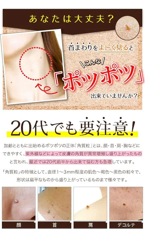 �y���������z �C�|�P�AEX �����̃|�c�|�c�P�A�ɂ������߁� �p���P�A ���e�t �p���� ���N�C�j�� �p�� �� �h���b�O�X�g�A_2