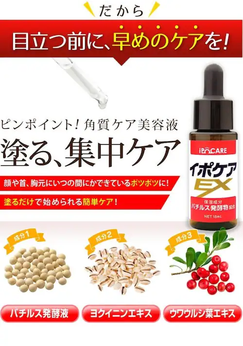 �y���������z �C�|�P�AEX �����̃|�c�|�c�P�A�ɂ������߁� �p���P�A ���e�t �p���� ���N�C�j�� �p�� �� �h���b�O�X�g�A_4