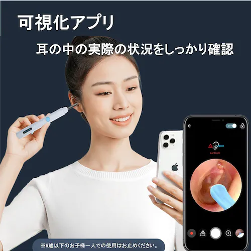 �J�����t�������� ������ ���|�� ���C���� �ɍ� �V���R���w�b�h 300����f �C���[�X�R�[�v LED���C�g ���C�����X Wi-Fi�ڑ� �[�d�� iPhone Android ��p�A�v��_9