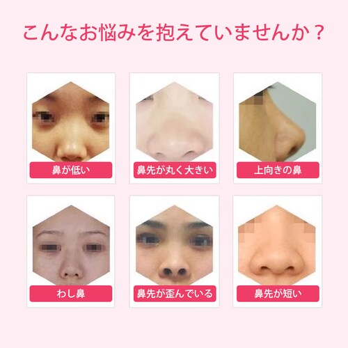 �@�N���b�v �m�[�Y�N���b�v �@ ���� ���@ ���@ �@�p �m�[�Y�t�B�b�g �T�|�[�g �O�b�Y �y�� �V���R�� �j�����p �t�B�b�g �A�C�e�� �P�A�O�b�Y �����Y ���f�B�[�X_1