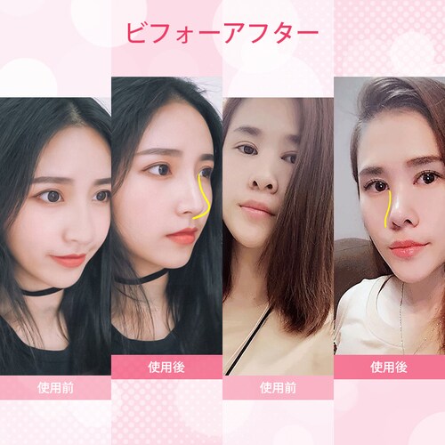 �@�N���b�v �m�[�Y�N���b�v �@ ���� ���@ ���@ �@�p �m�[�Y�t�B�b�g �T�|�[�g �O�b�Y �y�� �V���R�� �j�����p �t�B�b�g �A�C�e�� �P�A�O�b�Y �����Y ���f�B�[�X_12