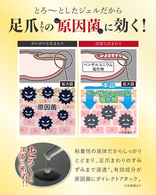 �y���������z��p���܃W�F���@�i��pAT�W�F���j�y�w���򕔊O�i�z���܂܂��̌����ۂɌ����I�L���������c���̊����E�������������P�A���܃g���u�� ���� �� �ܐ��� �ܔ�� �܂܂�� ���� �ێ� �܊��� _5