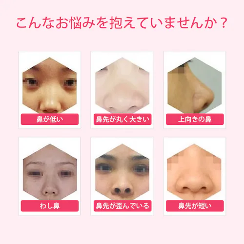 鼻クリップ ノーズクリップ 鼻 高く 美鼻 小鼻 鼻用 ノーズフィット サポート グッズ 軽量 シリコン 男女兼用 フィット アイテム ケアグッズ メンズ レディース_1