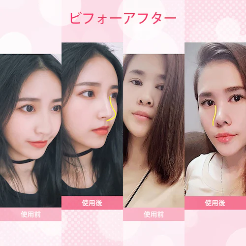 鼻クリップ ノーズクリップ 鼻 高く 美鼻 小鼻 鼻用 ノーズフィット サポート グッズ 軽量 シリコン 男女兼用 フィット アイテム ケアグッズ メンズ レディース_12