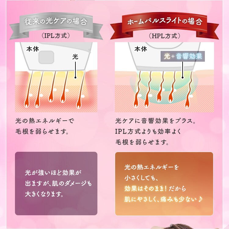 【訳あり】家庭用光美容器 自動照射 ホームパルスライト式 エピレタモーション EP-0337-P ピンク6